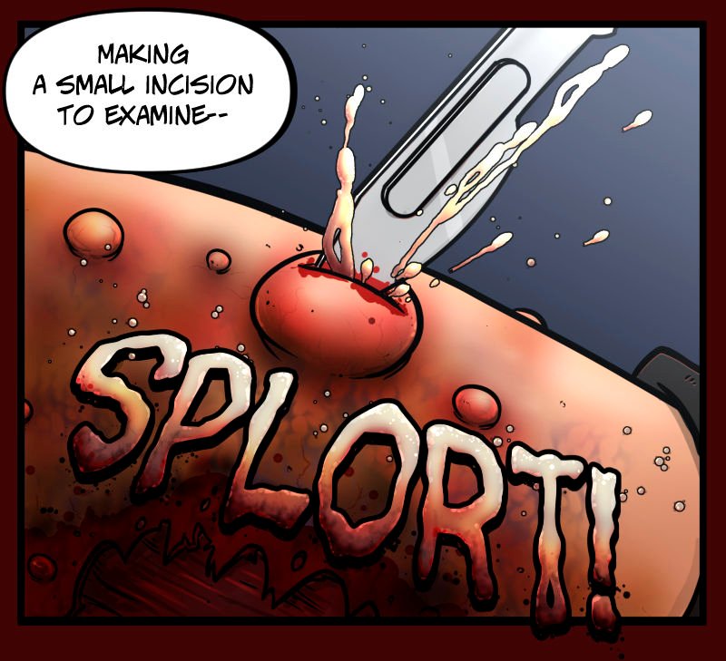 A scalpel pierces a swollen pustule on Ranâ€™s severed arm, releasing a violent spray of fluid. The burst is messy and sudden, with fluid flying in all directions. The large, stylized sound effect â€œSPLORT!â€ dominates the lower half of the panel in dripping letters.
