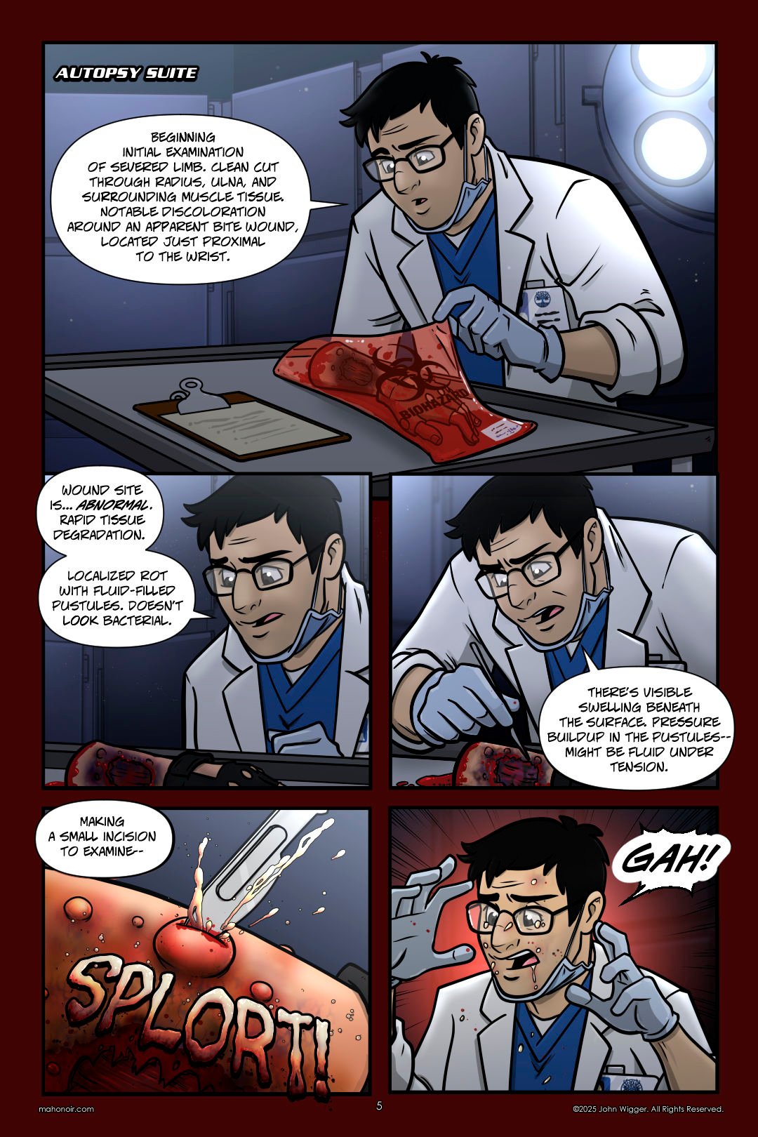 Panel 1
In a dimly lit autopsy suite, a medical examiner in a white lab coat and gloves examines Kimura Ranâ€™s severed arm, which is sealed in a blood-smeared biohazard bag. He wears glasses and a face mask pulled under his chin. A clipboard rests on the table, and bright surgical lights glow in the background.

Panel 2
In the autopsy suite, the medical examiner closely inspects Ranâ€™s severed arm, now unbagged and resting on the table. The wound site is visibly infected, with rapid tissue decay and dark, swollen pustules. The examiner frowns with concern, noting the abnormal condition. He wears a white lab coat, blue scrubs, and has his face mask pulled below his mouth.

Panel 3
The medical examiner leans in to probe Ranâ€™s severed, infected arm with a scalpel. He examines the swollen, darkened flesh with professional focus. Gloved and wearing a lab coat and blue scrubs, he notes visible swelling and tense pustules, indicating possible internal fluid buildup.

Panel 4
A scalpel pierces a swollen pustule on Ranâ€™s severed arm, releasing a violent spray of fluid. The burst is messy and sudden, with fluid flying in all directions. The large, stylized sound effect â€œSPLORT!â€ dominates the lower half of the panel in dripping letters.

Panel 5
The medical examiner recoils in panic, covered in splattered fluid from the burst pustule. His eyes are wide with fear, and several red blotches have appeared on his skin. His gloved hands are raised defensively, and his lab coat and face are stained. A red background emphasizes the shock and alarm of the moment.